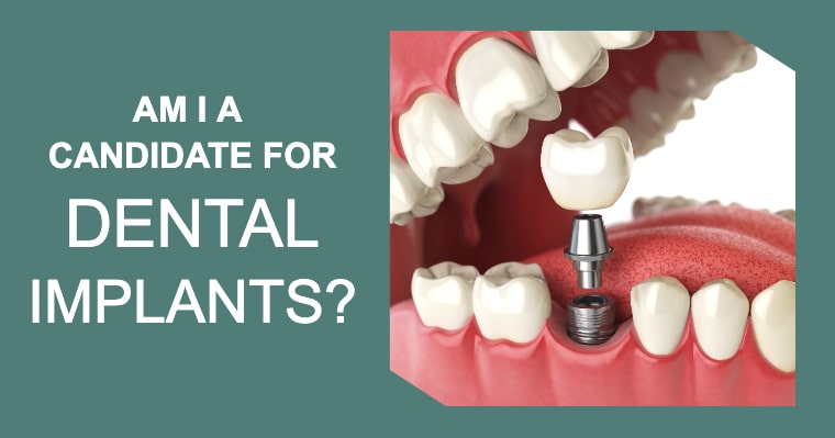 Am I A Candidate to Get Dental Implants?